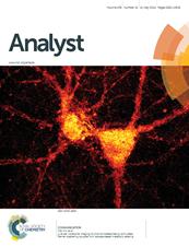 Live-cell vibrational imaging of choline metabolites by stimulated Raman scattering coupled with isotope-based metabolic labeling