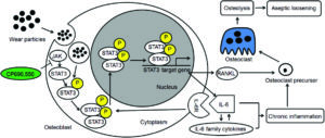 The schematic illustration of TiAl6V4 nanoparticle induced activation of the STAT3/IL-6 pathway resulting in the activation of osteoclast and osteolysis, which can be inhibited by CP690,550