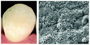 PEO-assisted precipitation of human enamel-like fluorapatite films for tooth whitening