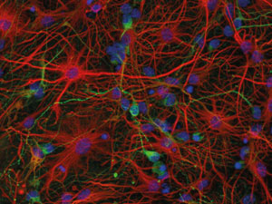 bIII-Tubulin positive murine neurons