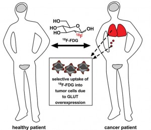 The strategy for glycoconjugation of anticancer drugs was inspired by the use of 18F-FDG, a radiolabeled glucose analogue used to visualise tumours.